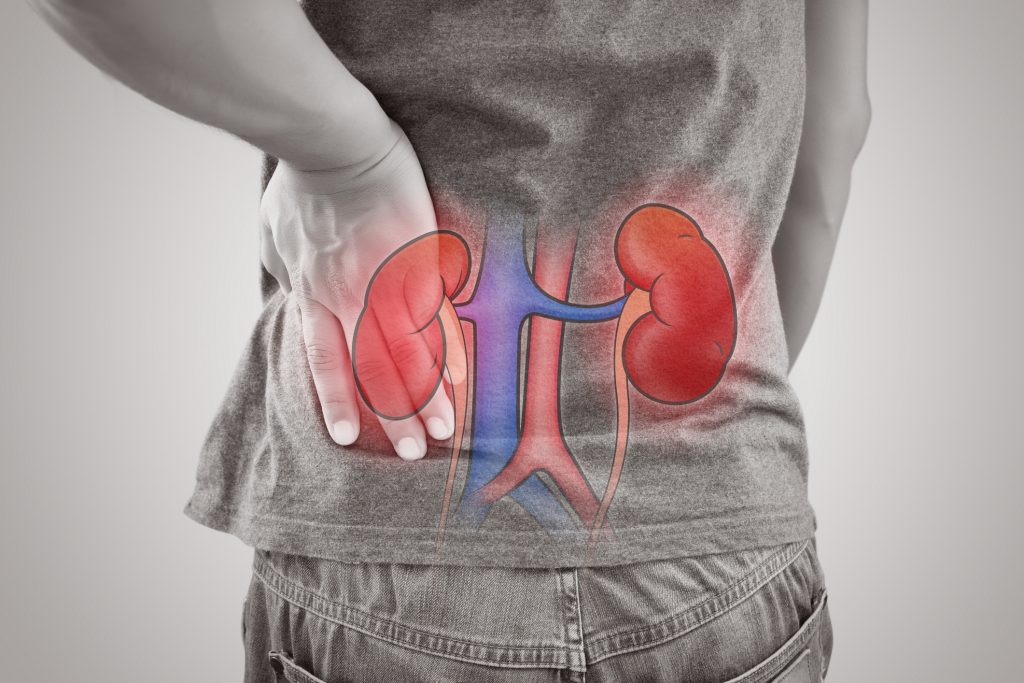 The Kidney Disease Solution Review: 100% Natural Based Program? Check it